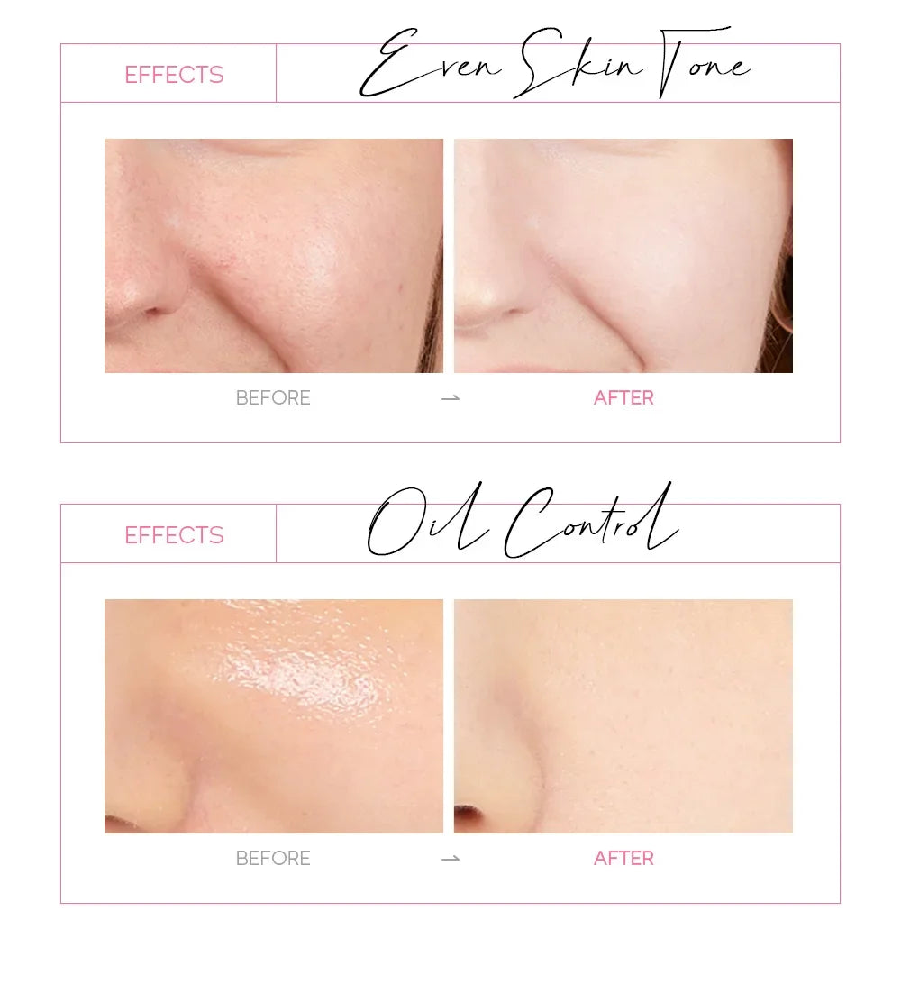 LAIKOU 24K Gold Sakura Peel-Off Face Mask – Anti-Wrinkle & Blackhead Removal