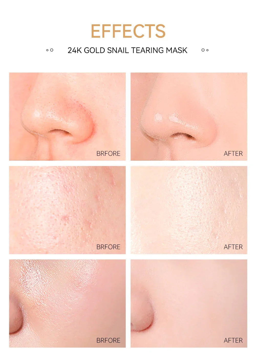 LAIKOU 24K Gold Sakura Peel-Off Face Mask – Anti-Wrinkle & Blackhead Removal