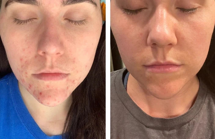 Beef Tallow Moisturizing Face Cream