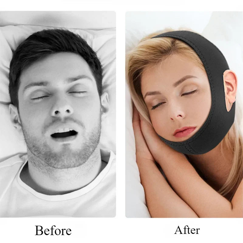 Anti-Snore Chin Strap – Night Sleep Support