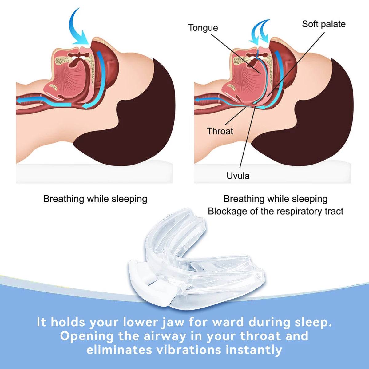 Adjustable Anti-Snoring Mouth Guard