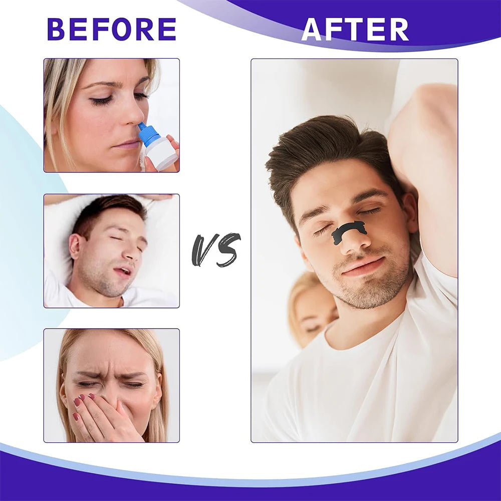 Black Extra Strength Nose Strips – Anti-Snoring