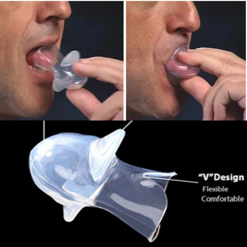 Medical Silicone Anti-Snore Device – Tongue Retainer Mouthpiece